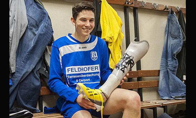 Fifa autorizó a futbolista amputado jugar con prótesis