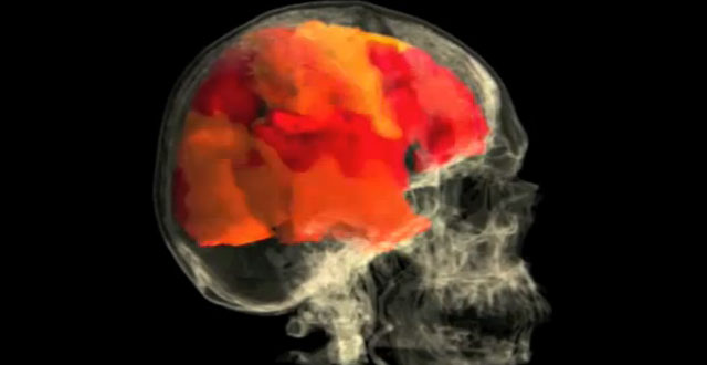 Así actúa el cerebro femenino durante el orgasmo (VIDEO)