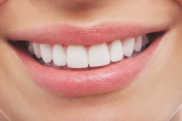 Trucos para lograr unos dientes perfectos