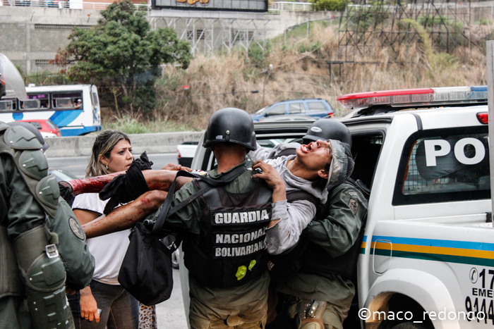 Video Exclusivo: Luego de detención, GNB hiere a quemarropa a un joven