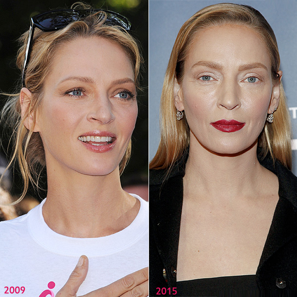 Expertos opinan sobre la transformación de Uma Thurman