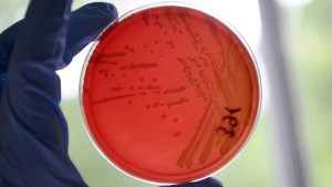 Hallan bacteria mortal en el exterior de un laboratorio de alta seguridad