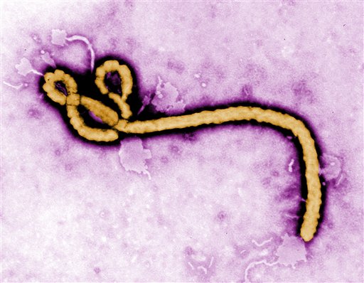 Detectan ébola en el ojo de un paciente curado