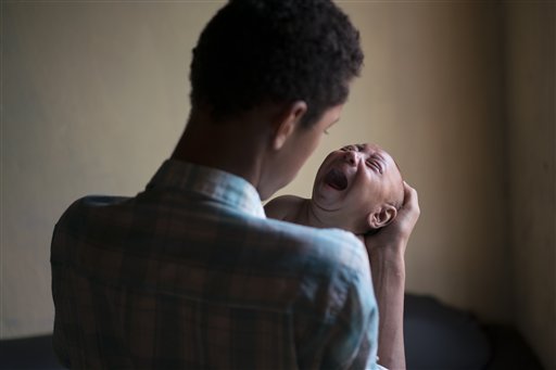 En esta imagen del 30 de enero de 2016, Elielson intenta calmar a su hermanito, José Wesley, en Bonito, en la provincia de Pernambuco, Brasil. José Wesley batalla para comer, algo común en los niños que sufren desórdenes neurológicos como la microcefalia. (Foto AP/Felipe Dana)