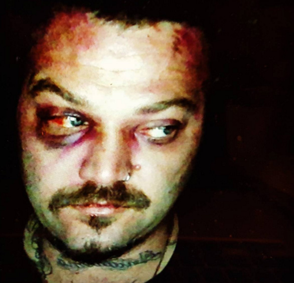 bam-margera