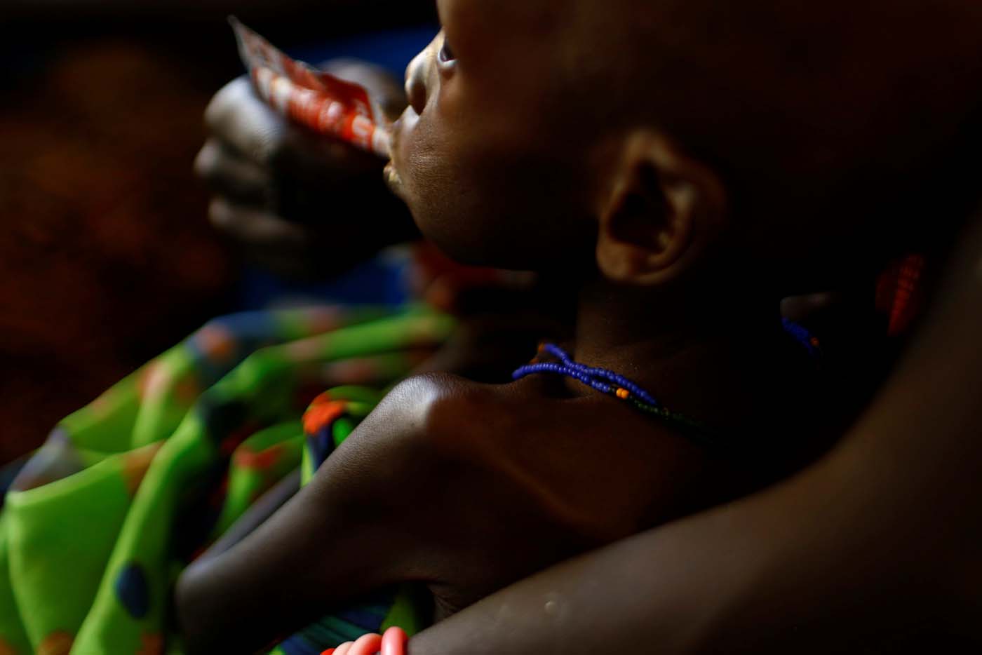 Sudán del Sur vive una hambruna que afecta a 100.000 personas