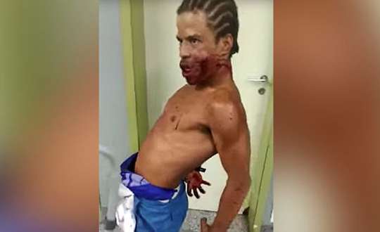 Un hombre “poseído” y con un disparo en la boca causó terror en un hospital (video)