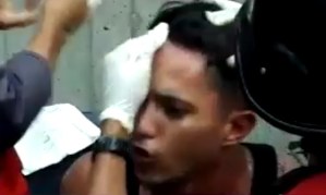 “Yo estoy luchando por mi Venezuela”… devastador VIDEO de un manifestante mientras atienden su herida en la cabeza