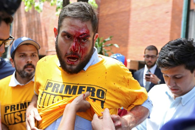 ATTENTION EDITORS - VISUAL COVERAGE OF SCENES OF INJURY OR DEATH FILE PHOTO: Juan Requesens (C), deputy of the Venezuelan coalition of opposition parties (MUD), is helped after being injured in clashes with pro-government supporters outside the offices of the Venezuela's ombudsman in Caracas, Venezuela April 3, 2017. REUTERS/Carlos Garcia Rawlins/File Photo TEMPLATE OUT