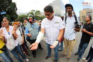 Diputado Olivares contabiliza 50 heridos, incluído él, por la represión este #22Jun