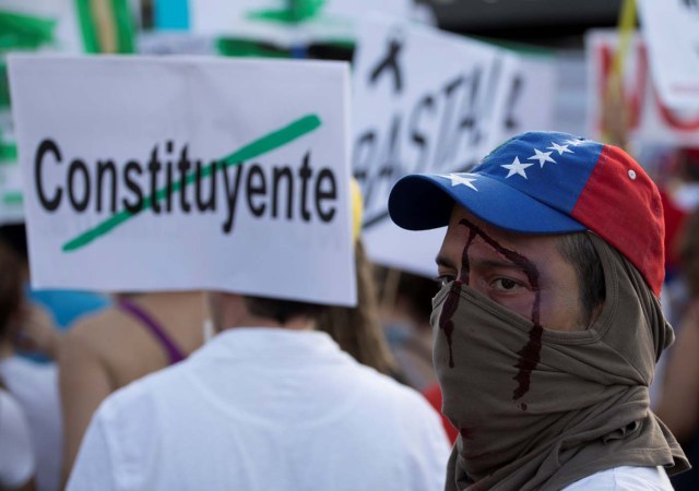 A demonstrator with a fake wound takes part in a protest held by Venezuelans in Spain against Venezuela's Constituent Assembly election, in Madrid, Spain, July 30, 2017. The placard reads "Constituent". REUTERS/Sergio Perez