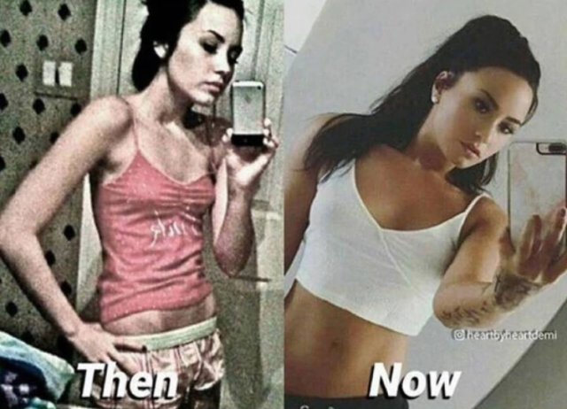 El antes y después de Demi Lovato. Infobae