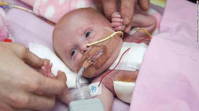 Three-week-old Vanellope Hope Wilkins, who was due to be delivered on Christmas Eve before an incredibly rare condition, in which the heart grows on the outside of the body, meant she had to be born prematurely by caesarean section on November 22, is caressed and touched by her parents Naomi Findlay and Dean Wilkins, at Glenfield Hospital in Leicester, after surviving, in what is believed to be a UK first. (Photo by Ben Birchall/PA Images via Getty Images)