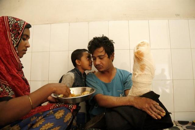 Abul Bajandar (dcha), conocido como 'hombre árbol', recibe comida de manos de su esposa, Halima Akter en una habitación de la unidad de quemados del hospital, en Daca, Bangladés, hoy, 30 de enero de 2018. Bajandar, quien permanecerá dos años en el hospital, ha sido sometido a 19 operaciones para eliminar las verrugas de sus extremidades. EFE/ Abir Abdullah