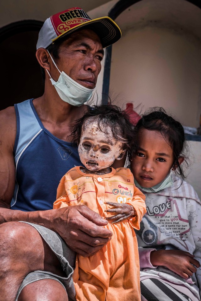 PIC BY Claudio Sieber / CATERS NEWS - (PICTURED a man holds his dead child) THESE images show a unique insight into the village where the living dig up their dead relatives to clean their bones and to dress them up. The dead can even remain in homes for decades until the family throw a huge party in their honour. The corpses are treated as sick until they finally find peace after funeral rites known as Rambu Solo The bizarre ritual was pictured in South Sulawesi, Indonesia, where even buried relatives are taken out of their coffins for new outfits and a bone polish. SEE CATERS COPY