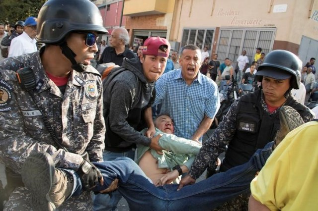 Teodoro Campos, legislador opositor y jefe de seguridad del candidato presidencial venezolano Henri Falcón, recibe ayuda luego de sufrir una lesión durante un mitin de Falcón en Caracas, Venezuela, 2 de abril del 2018. REUTERS/Rayner Peña