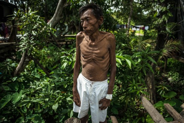 Abraham Navarro, de 50 años, posó para un retrato fuera de su casa. Navarro murió cinco días después. Los médicos le diagnosticaron VIH y tuberculosis, pero debido a la escasez de medicamentos, no pudo recibir el tratamiento completo. Credit Meridith Kohut para The New York Times