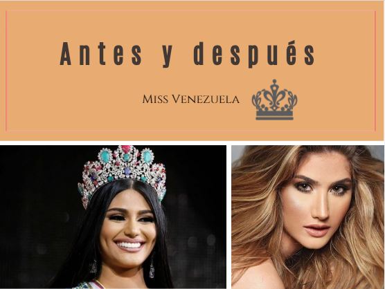 ¡Irreconocibles! Los impactantes antes y después de estas Miss Venezuela