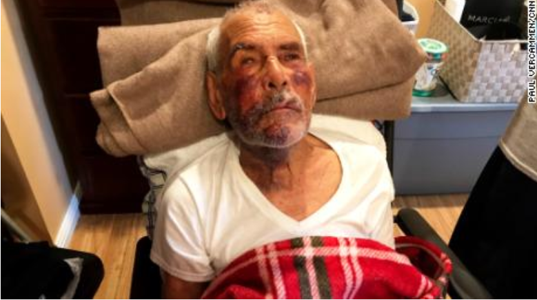 Detienen en EEUU a sospechosa de golpear a mexicano de 91 años con ladrillo