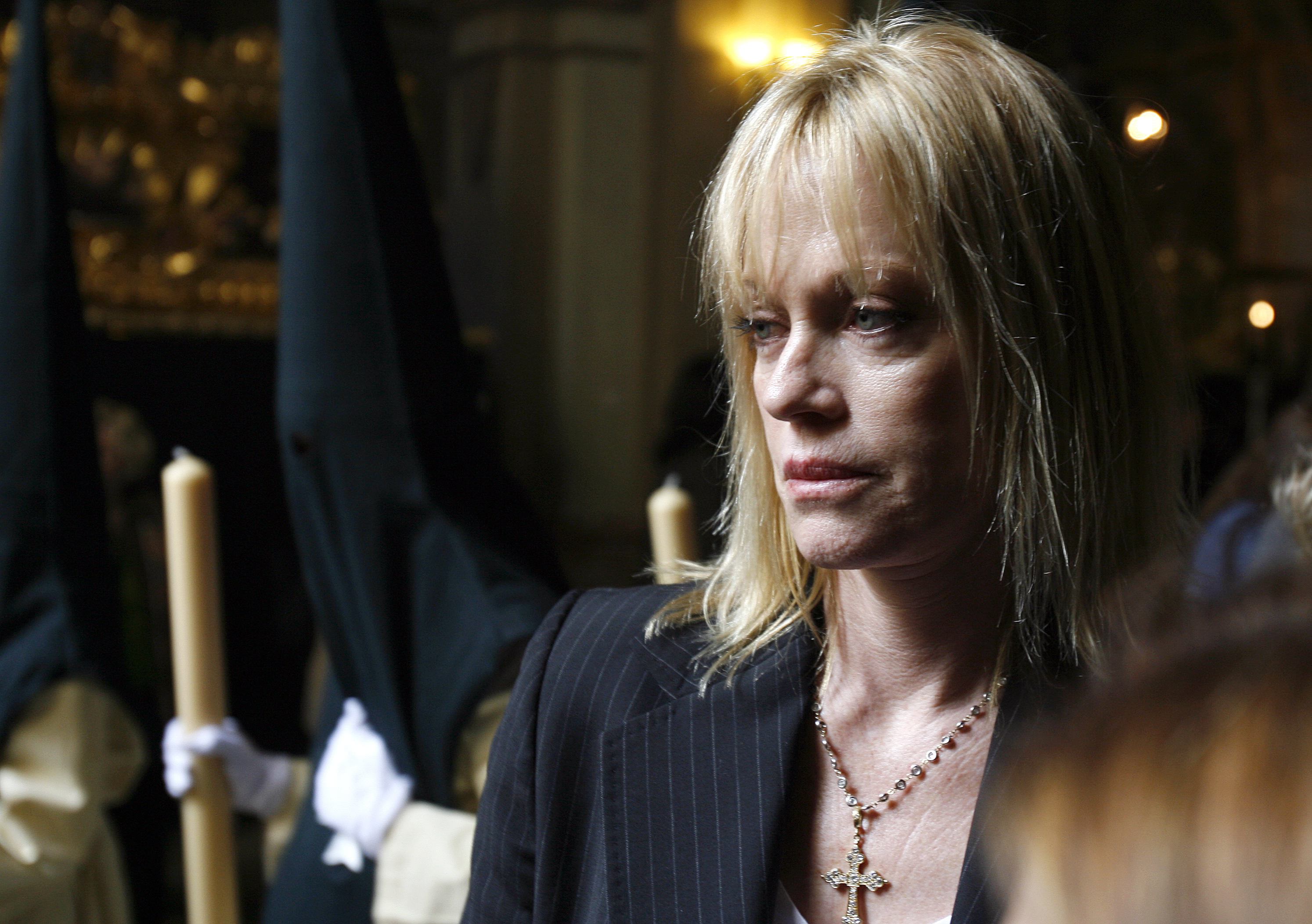 Melanie Griffith exhibe el devastador efecto del cáncer de piel en su rostro (Foto)