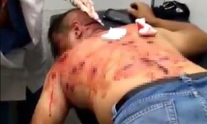 EN VIDEO: Ciudadano herido por perdigones en Ureña (Imágenes fuertes)