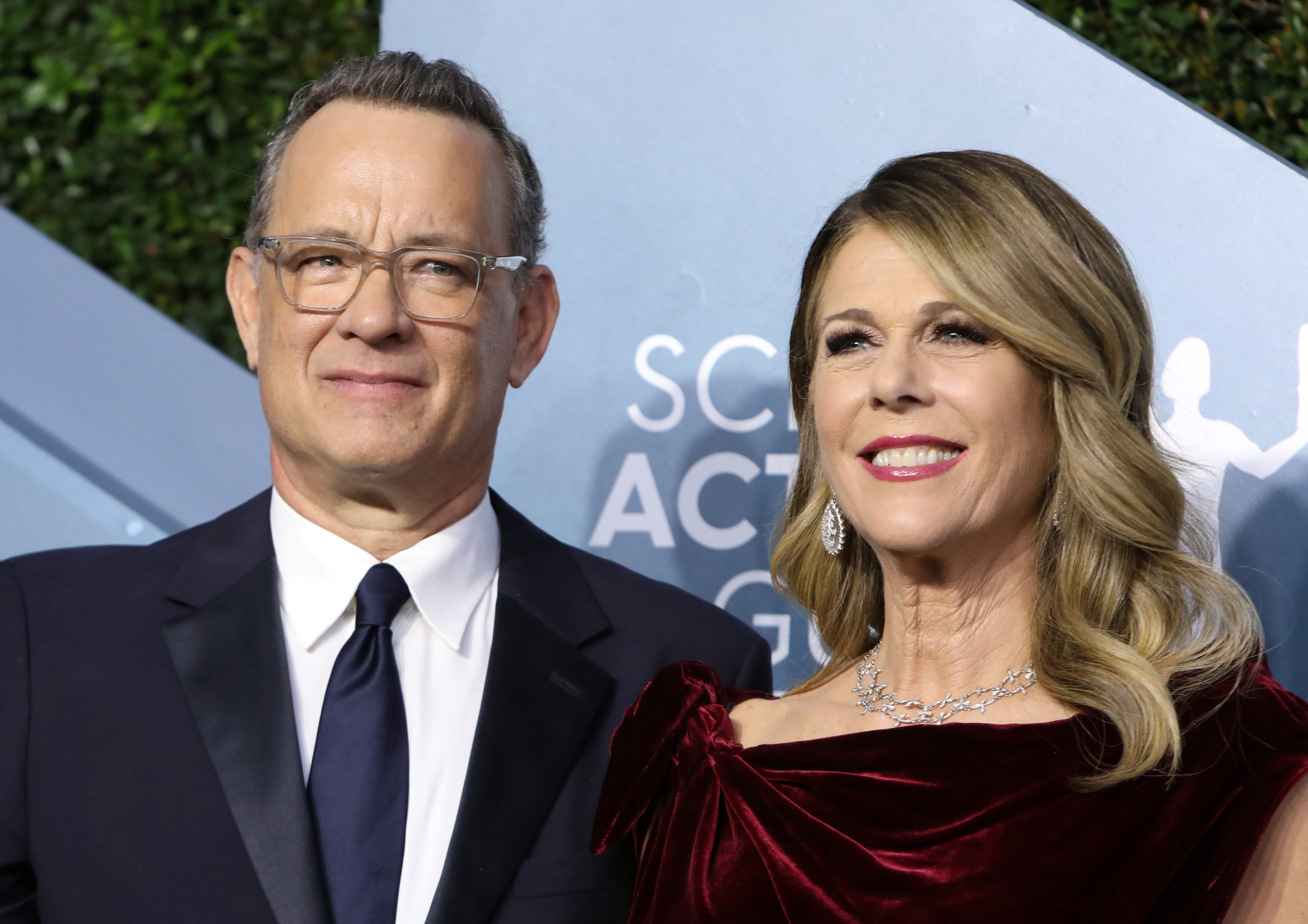 ¡Increíble! Así lucen Tom Hanks y su esposa tras dar positivo por coronavirus (FOTO)