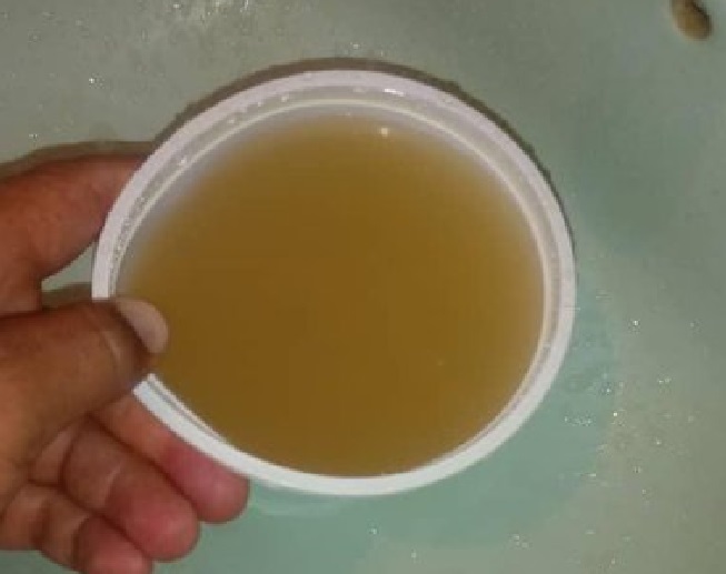 EN FOTOS: Así de oscura está saliendo el agua por las tuberías del Zulia #18Jun