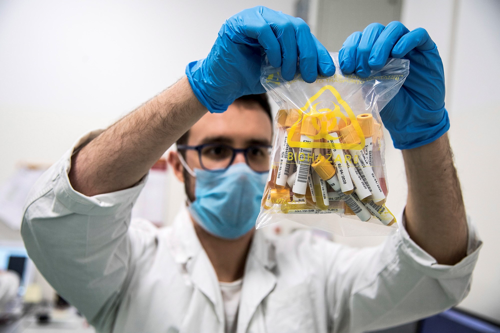 Italia comenzó la primera fase de ensayos de su vacuna en humanos
