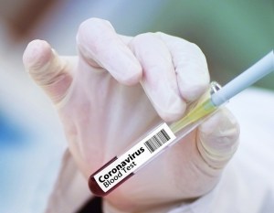 EEUU canceló el ensayo de un prometedor tratamiento contra el Covid-19 por falta de resultados