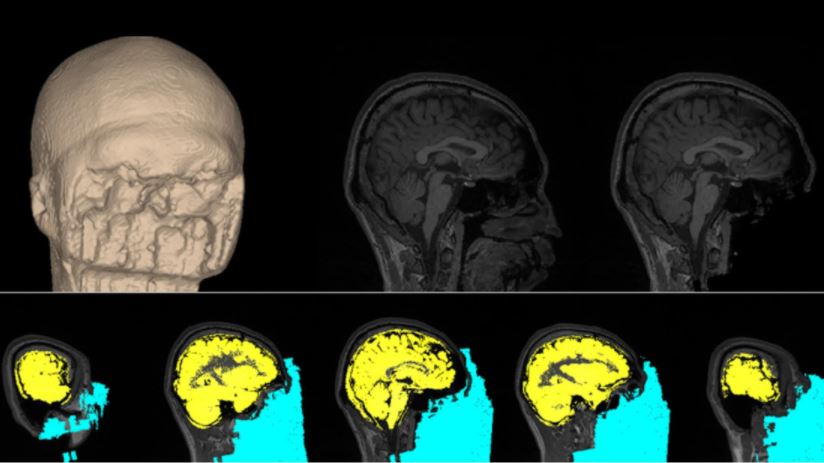 Desarrollan un método que puede modificar el funcionamiento del cerebro