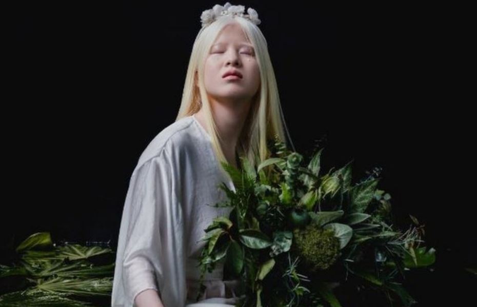 La joven albina abandonada en China de bebé que se convirtió en modelo de Vogue