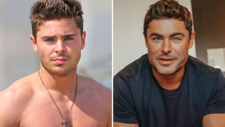 “Voy a demandar al cirujano”: El “nuevo rostro” de Zac Efron desató críticas