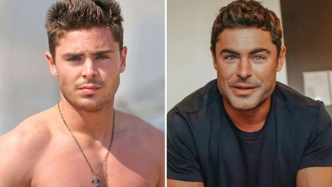 Zac Efron reapareció después del escándalo por su rostro “deformado” (FOTOS)