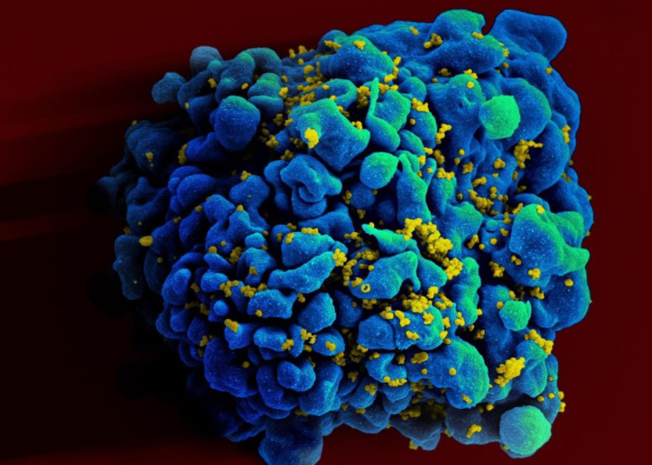 Una mujer argentina se habría curado de VIH por inmunidad natural