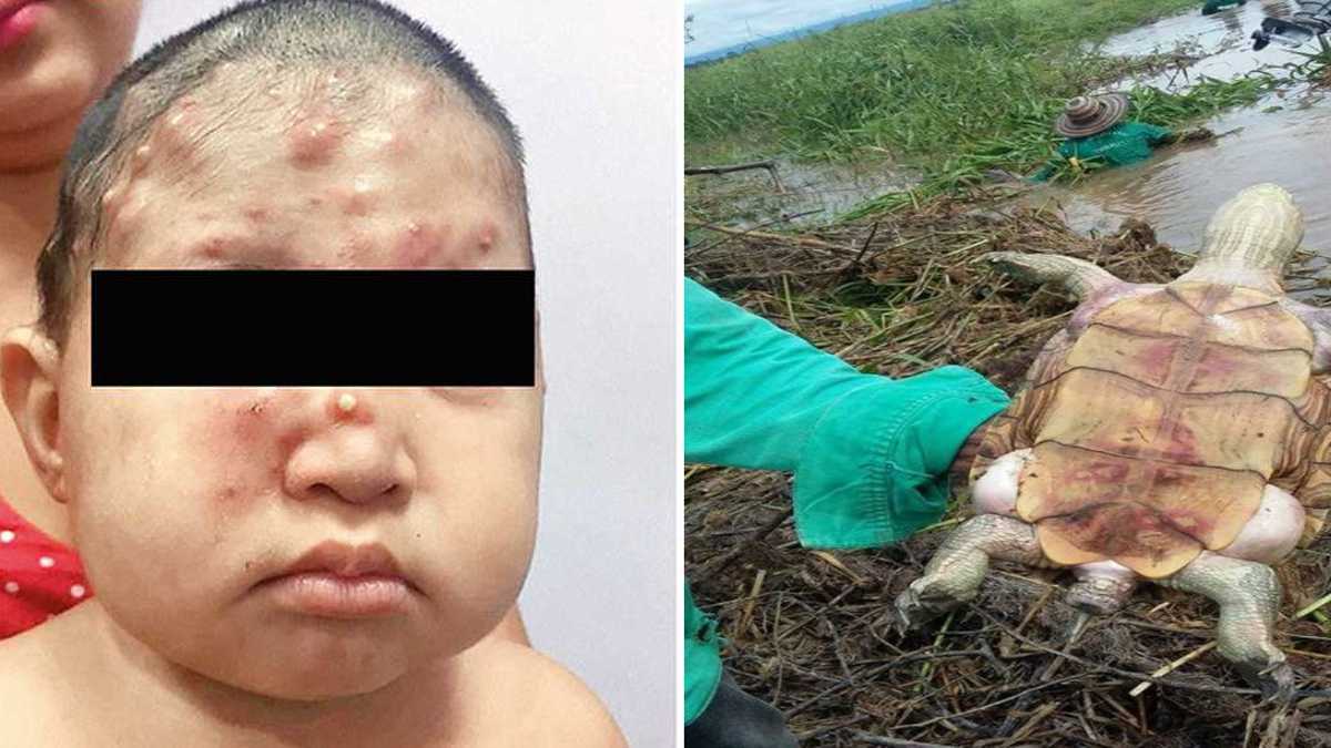 Las impresionantes mutaciones en niños y animales que viven cerca del relleno sanitario en Santander, Colombia