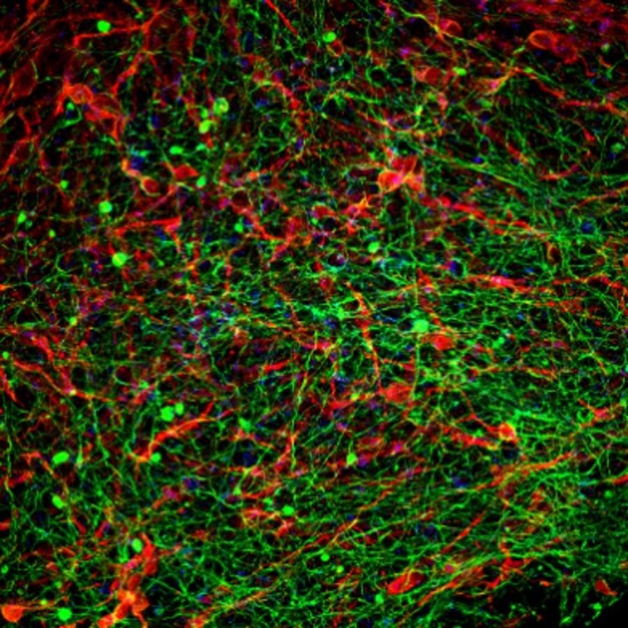 Estudio israelí busca revertir la parálisis crónica con implantes de médula espinal