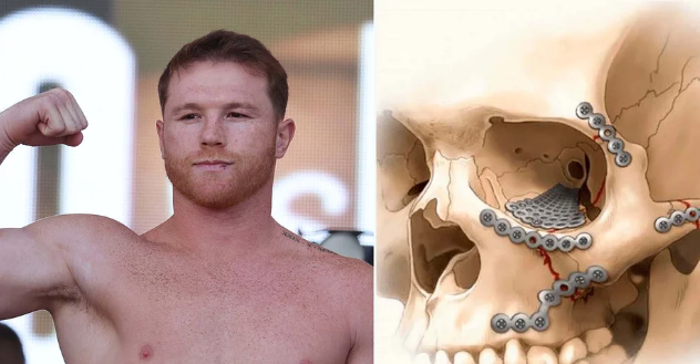 Qué fue del boxeador al que Canelo Álvarez casi deja en el retiro por una triple fractura en la cuenca del ojo