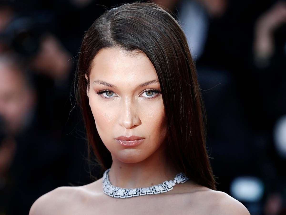 Las FOTOS preocupantes de Bella Hadid con su espalda llena de vendas y piernas con moretones