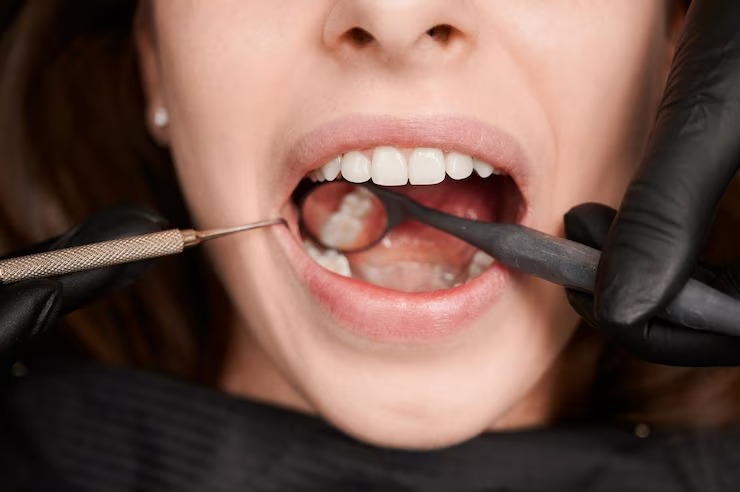 Fue al dentista para sacarse una muela, terminó en cuidados intensivos y murió