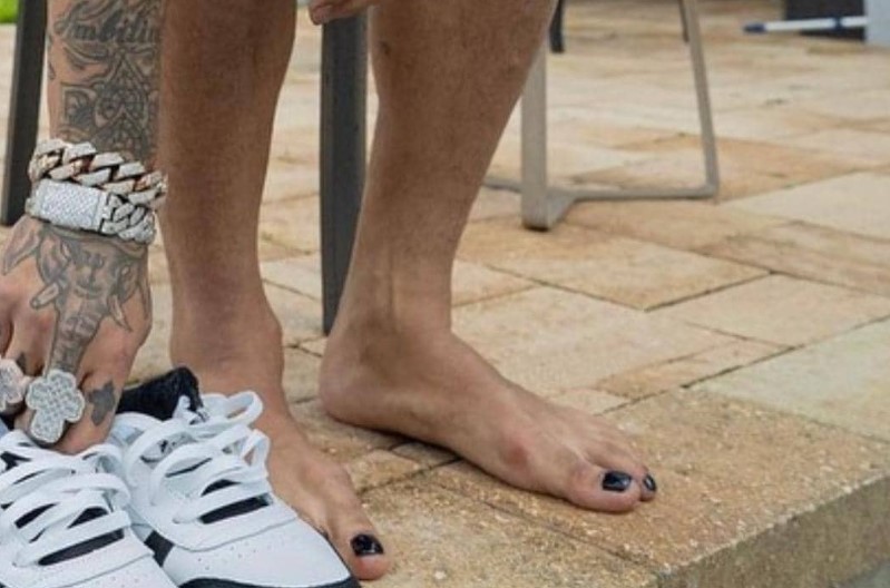 ¡Uy, no! Aseguran que Anuel AA tiene hongos en los pies por estas fotos que se filtraron en redes