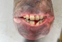 VIDEO: Se sorprendió al capturar enorme pez con la boca llena de “dientes humanos” en Maryland