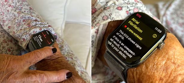 Joven relató sorprendentemente cómo un reloj inteligente salvó la vida de su abuela