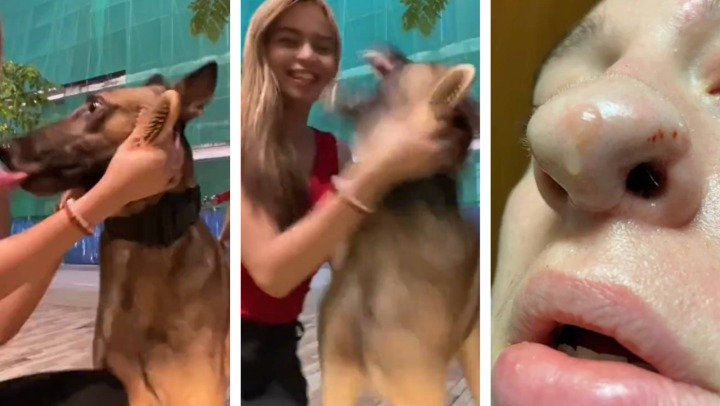 VIDEO: Perro le arrancó la nariz, tuvieron que injertarle piel y ahora le crecen pelos