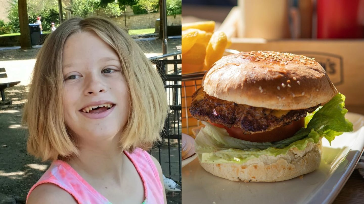 Misterio en Massachusetts: Niño de 12 años quedó ciego tras alimentarse a base de hamburguesas y donas