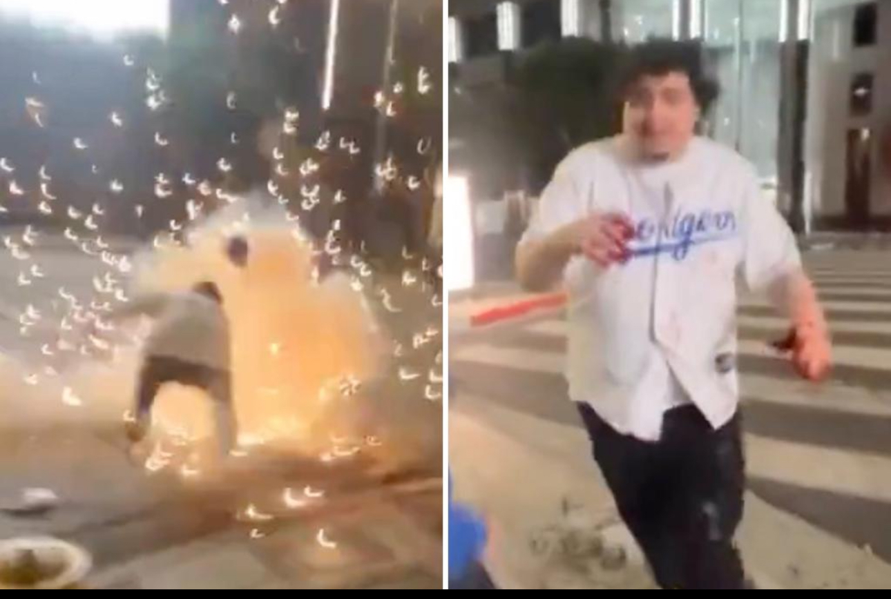 Fanático de los Dodgers sufrió graves heridas al detonar un fuego artificial durante celebración